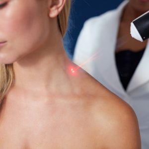 laser therapy